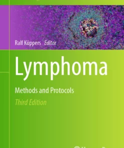 Lymphoma: Methods and Protocols