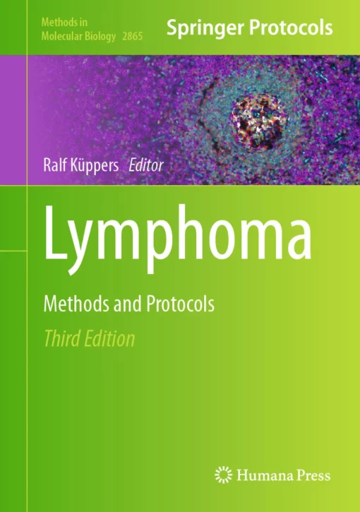 Lymphoma: Methods and Protocols