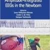 An Atlas of Amplitude-Integrated EEGs in the Newborn, 3rd edition (PDF)