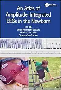 An Atlas of Amplitude-Integrated EEGs in the Newborn, 3rd edition (PDF)