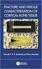 Fracture and Fatigue Characterisation of Cortical Bone Tissue (EPUB)