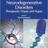 Nanocarriers in Neurodegenerative Disorders: Therapeutic Hopes and Hypes (EPUB)