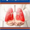 Essentials of Lung Transplantation (EPUB)