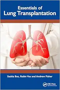 Essentials of Lung Transplantation (EPUB)