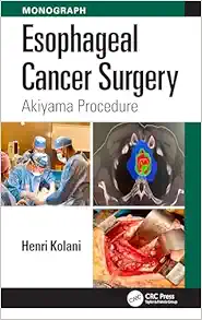 Esophageal Cancer Surgery: Akiyama Procedure (EPUB)