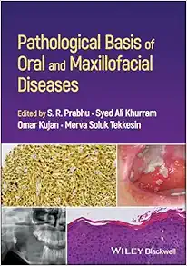 Pathological Basis of Oral and Maxillofacial Diseases (EPUB)