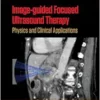 Image-guided Focused Ultrasound Therapy: Physics and Clinical Applications (Series in Medical Physics and Biomedical Engineering) (EPUB)