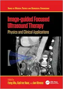 Image-guided Focused Ultrasound Therapy: Physics and Clinical Applications (Series in Medical Physics and Biomedical Engineering) (EPUB)