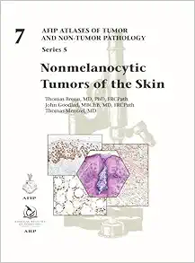 Nonmelanocytic Tumors of the Skin (AFIP Atlas of Tumor and Non-Tumor Pathology, Series 5, Fascicle 7) (PDF)