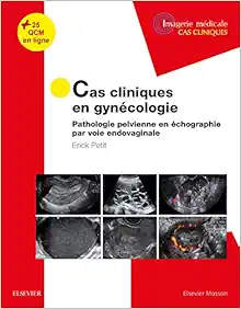 Cas Cliniques En Gynécologie: Pathologie Pelvienne En Échographie Par Voie Endovaginale (French Edition) (True PDF+Videos)