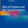 Atlas of Common and Rare Genodermatoses: