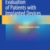 Echocardiographic Evaluation of Patients with Implanted Devices: