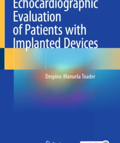 Echocardiographic Evaluation of Patients with Implanted Devices: