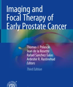 Imaging and Focal Therapy of Early Prostate Cancer: