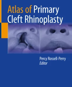 Atlas of Primary Cleft Rhinoplasty: