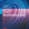 Fetal Neurosonography: