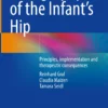 Sonography of the Infant’s Hip: Principles, implementation and therapeutic consequences