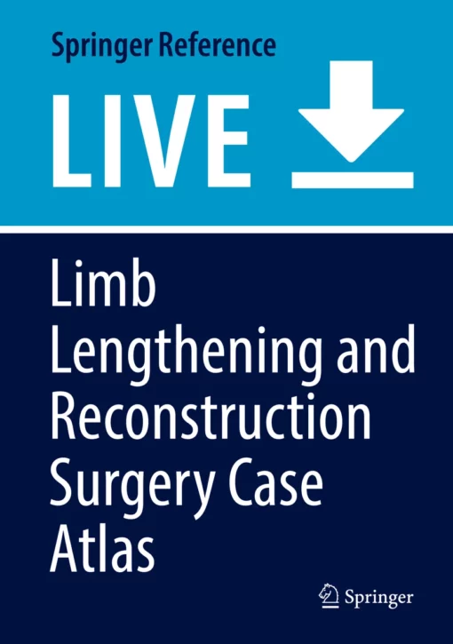 Limb Lengthening and Reconstruction Surgery Case Atlas: