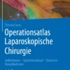 Operationsatlas Laparoskopische Chirurgie: Indikationen – Operationsablauf – Varianten – Komplikationen