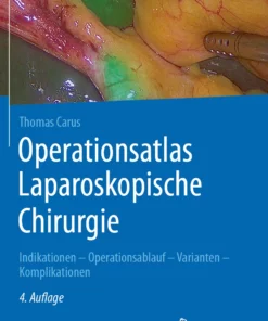 Operationsatlas Laparoskopische Chirurgie: Indikationen – Operationsablauf – Varianten – Komplikationen