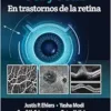 OCT y OCTA en trastornos de la retina (Spanish Edition) (PDF)