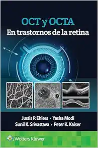 OCT y OCTA en trastornos de la retina (Spanish Edition) (PDF)