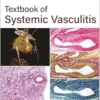 Textbook of Systemic Vasculitis, 2nd Edition (EPUB)
