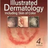 Illustrated Dermatology, 4th Edition (EPUB)
