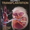 Textbook of Kidney Transplantation (EPUB)