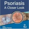 Psoriasis: A Closer Look, 2nd Edition (EPUB)