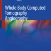 Whole Body Computed Tomography Angiography: