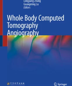 Whole Body Computed Tomography Angiography: