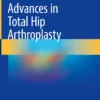 Advances in Total Hip Arthroplasty: