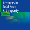 Advances in Total Knee Arthroplasty: