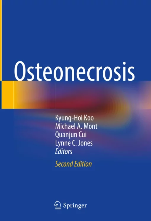 Osteonecrosis: