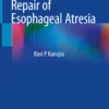 Thoracoscopic Repair of Esophageal Atresia: