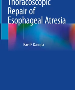 Thoracoscopic Repair of Esophageal Atresia:
