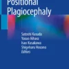 Handbook of Positional Plagiocephaly: