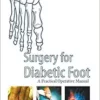 Surgery For Diabetic Foot: A Practical Operative Manual (PDF)