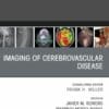 Imaging of Cerebrovascular Disease, An Issue of Radiologic Clinics of North America (PDF)