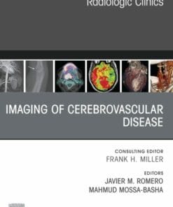 Imaging of Cerebrovascular Disease, An Issue of Radiologic Clinics of North America (PDF)