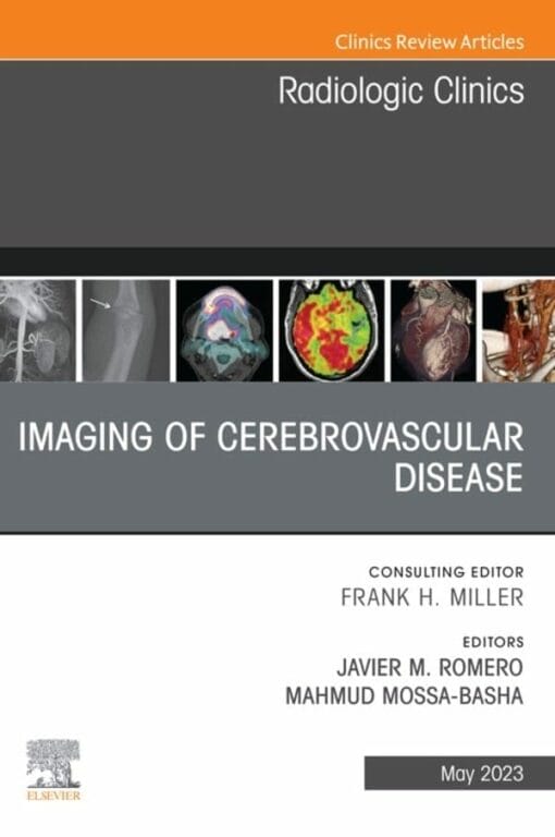 Imaging of Cerebrovascular Disease, An Issue of Radiologic Clinics of North America (PDF)