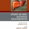 Update on Non-Alcoholic Steatohepatitis, An Issue of Clinics in Liver Disease (PDF)