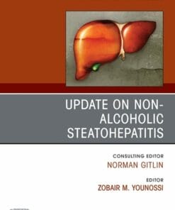 Update on Non-Alcoholic Steatohepatitis, An Issue of Clinics in Liver Disease (PDF)