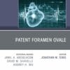 Patent Foramen Ovale, An Issue of Cardiology Clinics (True PDF from Publisher)