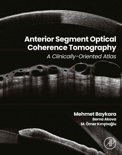 Anterior Segment Optical Coherence Tomography: A Clinically-Oriented Atlas (True PDF)