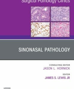 Sinonasal Pathology, An Issue of Surgical Pathology Clinics (PDF)