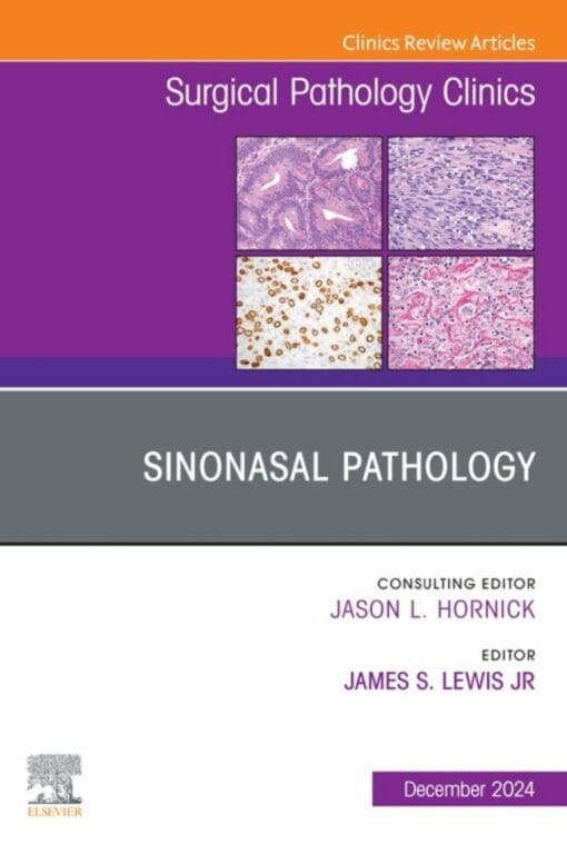 Sinonasal Pathology, An Issue of Surgical Pathology Clinics (PDF)