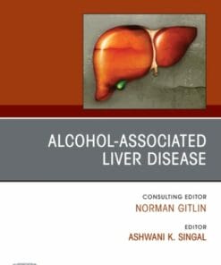 Alcohol-Associated Liver Disease, An Issue of Clinics in Liver Disease (True PDF from Publisher)