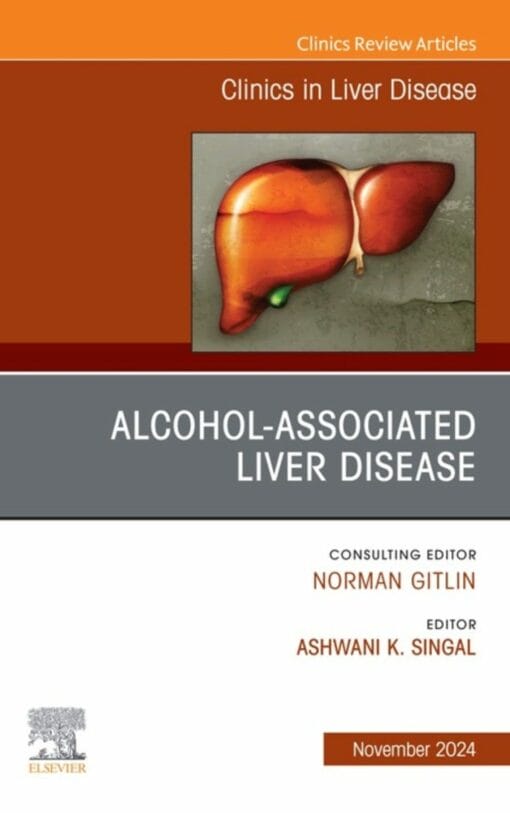 Alcohol-Associated Liver Disease, An Issue of Clinics in Liver Disease (True PDF from Publisher)